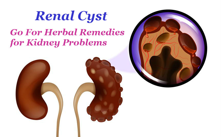 Herbal Remedies for Kidney Problems